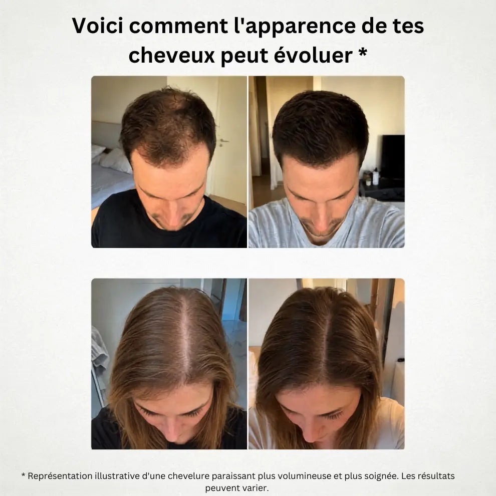 Huile capillaire Premium BIO Croissance+
