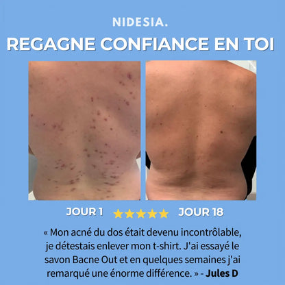 Savon Anti-Acné
