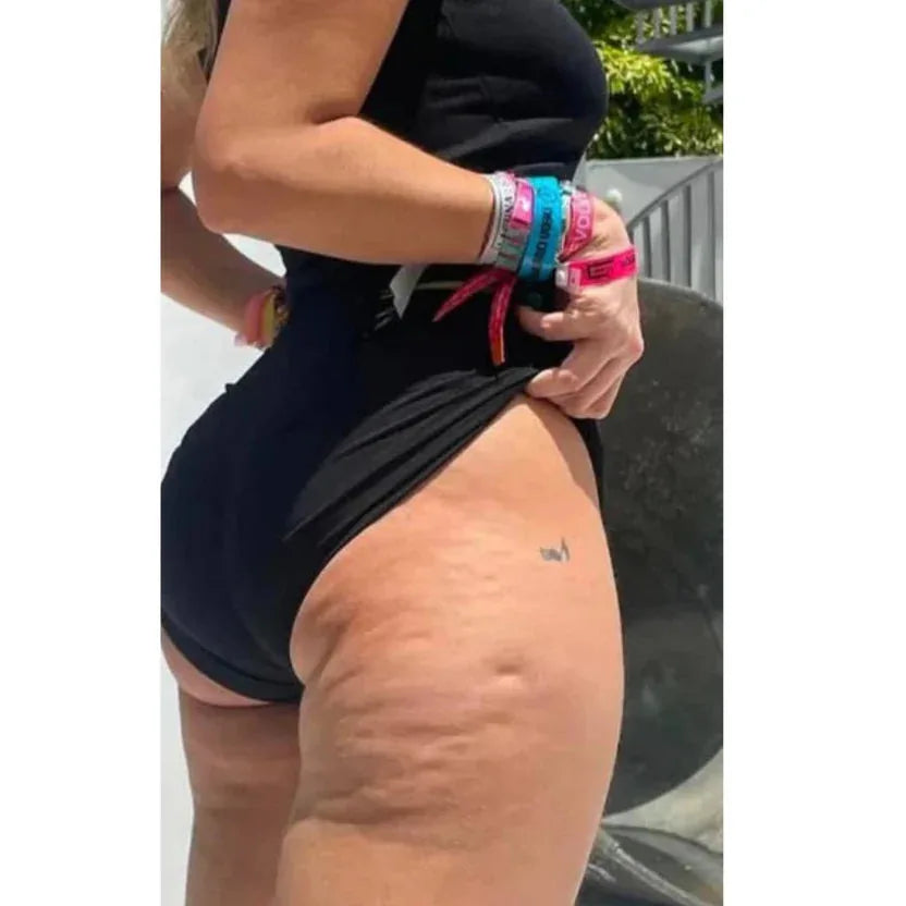 vacumify cellulite stop section sichtbare 01