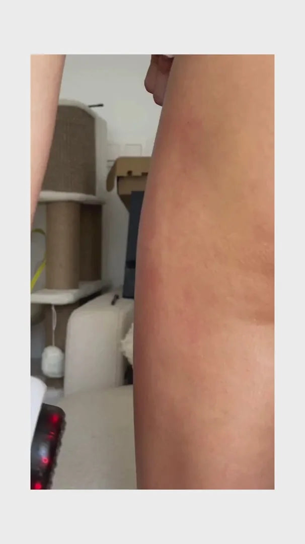 vacumify cellulite stop video ugc poster 02